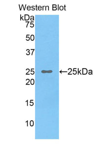 Polyclonal Antibody to Osteoclast Stimulating Factor 1 (OSF)