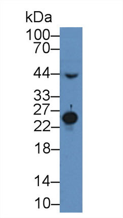 Polyclonal Antibody to Mannose Binding Lectin (MBL)