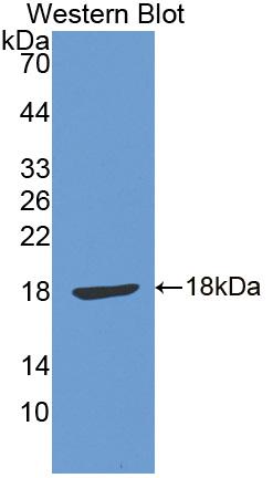 Polyclonal Antibody to N-cadherin (NCAD)