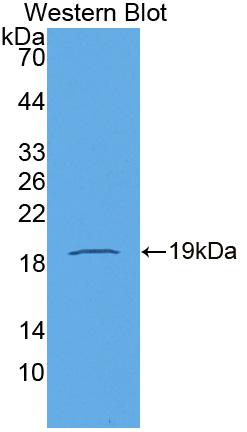 Polyclonal Antibody to N-cadherin (NCAD)