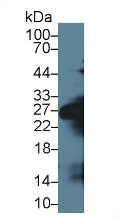 Polyclonal Antibody to Pancreatic Elastase 1 (ELA1)