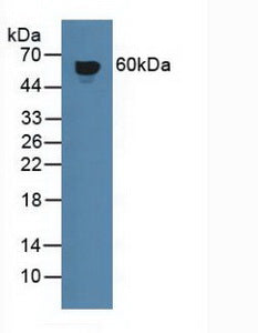 Polyclonal Antibody to Interferon Gamma Receptor 1 (IFNgR1)