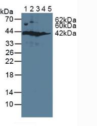 Polyclonal Antibody to Sorbitol Dehydrogenase (SDH)