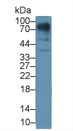 Polyclonal Antibody to Lumican (LUM)