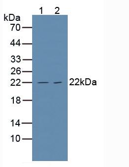 Polyclonal Antibody to Tumor Necrosis Factor Receptor 1 (TNFR1)