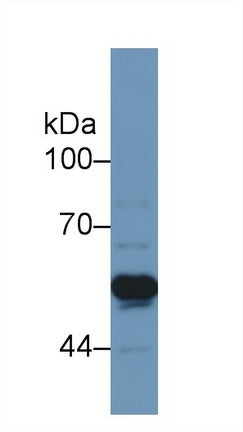 Polyclonal Antibody to Tumor Necrosis Factor Receptor 1 (TNFR1)