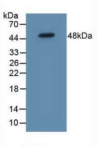 Polyclonal Antibody to Interleukin 5 Receptor Alpha (IL5Ra)