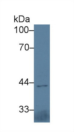 Polyclonal Antibody to Interleukin 5 Receptor Alpha (IL5Ra)