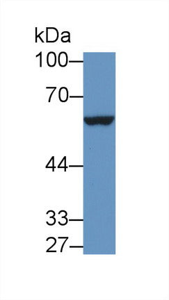 Polyclonal Antibody to Interleukin 9 Receptor (IL9R)