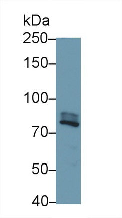 Polyclonal Antibody to Interleukin 1 Receptor Associated Kinase 1 (IRAK1)