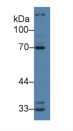 Polyclonal Antibody to Interleukin 1 Receptor Associated Kinase 2 (IRAK2)