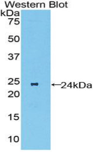 Polyclonal Antibody to Macrophage Stimulating 1 Receptor (MST1R)