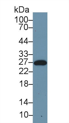 Polyclonal Antibody to Serum Amyloid P Component (SAP)