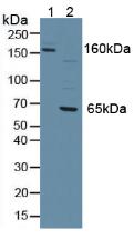 Polyclonal Antibody to Density Enhanced Phosphatase 1 (DEP1)