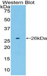 Polyclonal Antibody to Large Multifunctional Peptidase 7 (LMP7)