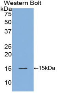 Polyclonal Antibody to Fatty Acid Binding Protein 1 (FABP1)
