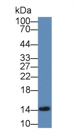 Polyclonal Antibody to Fatty Acid Binding Protein 1 (FABP1)