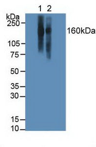 Polyclonal Antibody to Lymphocyte Function Associated Antigen 1 Alpha (CD11a)