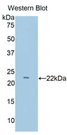 Polyclonal Antibody to Cluster Of Differentiation 2 (CD2)