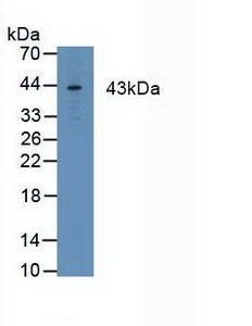 Polyclonal Antibody to Cluster Of Differentiation 64 (CD64)