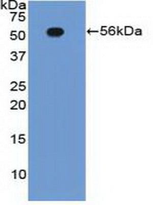 Polyclonal Antibody to Integrin Beta 2 (CD18)