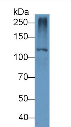 Polyclonal Antibody to Tyrosine Kinase 2 (Tyk2)