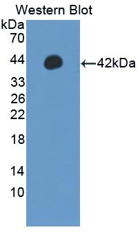 Polyclonal Antibody to Interferon Regulatory Factor 5 (IRF5)
