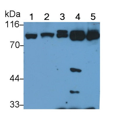 Polyclonal Antibody to Glucocorticoid Receptor (GR)