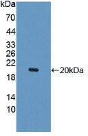 Polyclonal Antibody to Interleukin 10 Receptor Beta (IL10Rb)