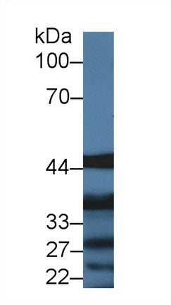 Polyclonal Antibody to Interleukin 13 Receptor Alpha 1 (IL13Ra1)
