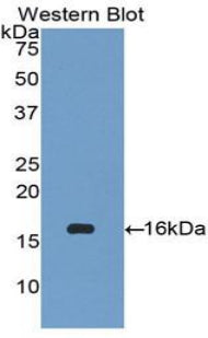 Polyclonal Antibody to Chemokine (C-X-C Motif) Ligand 27 (CCL27)