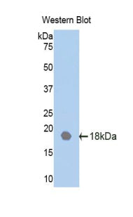 Polyclonal Antibody to Interleukin-18 Receptor Beta (IL18R Beta)