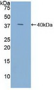 Polyclonal Antibody to Trefoil Factor 3 (TFF3)