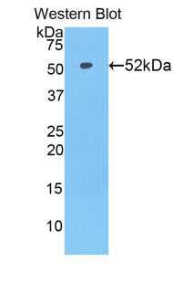 Polyclonal Antibody to Solute Carrier Family 27 Member 5 (SLC27A5)