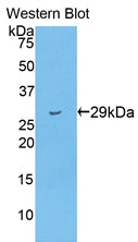 Polyclonal Antibody to Titin (TTN)