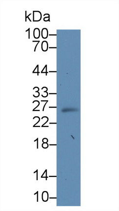 Polyclonal Antibody to Suppressors Of Cytokine Signaling 3 (SOCS3)