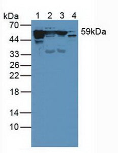 Polyclonal Antibody to Cytokeratin 10 (CK10)