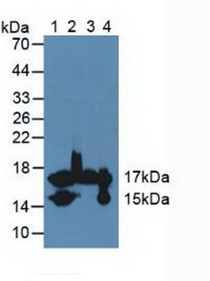 Polyclonal Antibody to Fatty Acid Binding Protein 4 (FABP4)