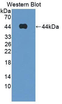 Polyclonal Antibody to Fatty Acid Binding Protein 4 (FABP4)