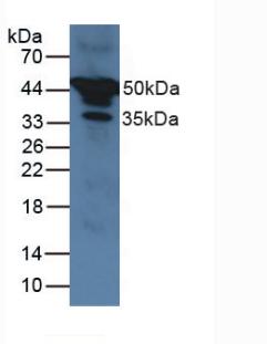 Polyclonal Antibody to Alpha-1-Antitrypsin (a1AT)