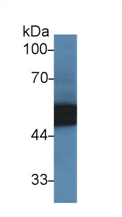 Polyclonal Antibody to Alpha-1-Antitrypsin (a1AT)