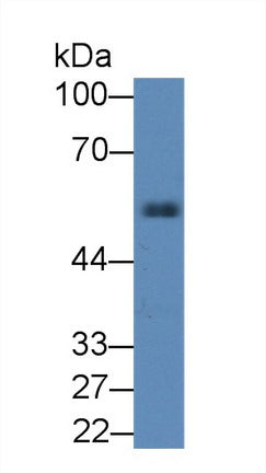 Polyclonal Antibody to Alpha-1-Antitrypsin (a1AT)