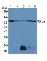 Polyclonal Antibody to Lactate Dehydrogenase B (LDHB)