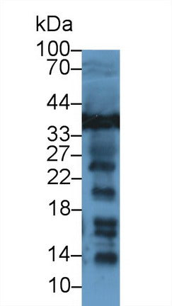Polyclonal Antibody to Lactate Dehydrogenase B (LDHB)