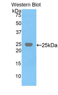 Polyclonal Antibody to Farnesyl Diphosphate Farnesyltransferase 1 (FDFT1)
