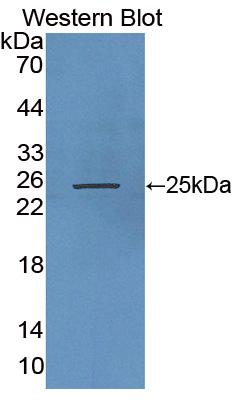 Polyclonal Antibody to Rh Associated Glycoprotein (RHAG)