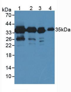 Polyclonal Antibody to Pyridoxal Kinase (PDXK)