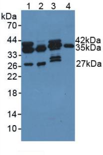 Polyclonal Antibody to Pyridoxal Kinase (PDXK)