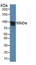 Polyclonal Antibody to Signal Transducer And Activator Of Transcription 5B (STAT5B)