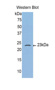 Polyclonal Antibody to Caspase 4 (CASP4)